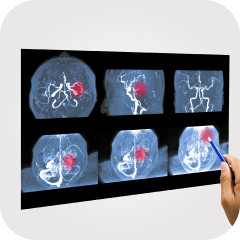 Angiographie